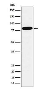 Western blot analysis of ABCD1 / ALD in HepG2 cell lysate using ABCD1 antibody.