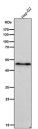 All lanes use the Phospho-VASP (Ser156) antibody at 1:5K dilution for 1 hour at room temperature.