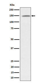 Western blot analysis of phospho-Phospholipase C gamma 1/PLC-gamma-1 (Y1253) expression in Jurkat treated with Pervanadate lysate, using Phospho-Phospholipase C gamma 1 (Tyr1253) antibody.