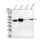 Western blot analysis of GBA3 using anti-GBA3 antibody. Lane 1: rat liver tissue lysates, Lane 2: rat kidney tissue lysates, Lane 3: mouse liver tissue lysates, Lane 4: mouse kidney tissue lysates. After electrophoresis, proteins were transferred to a nitrocellulose membrane at 150 mA for 50-90 minutes. Blocked the membrane with 5% non-fat milk/TBS for 1.5 hour at RT. The membrane was incubated with rabbit anti-GBA3 antibody at 0.5 ug/ml overnight at 4oC, then washed with TBS-0.1%Tween 3 times with 5 minutes each and probed with a goat anti-rabbit IgG-HRP secondary antibody at a dilution of 1:5000 for 1.5 hour at RT. The signal was developed using enhanced chemiluminescent. The expected band size for GBA3 is at 54 kDa.