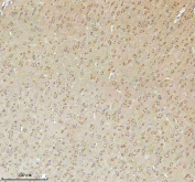 Immunohistochemical staining of NRTN using anti-NRTN antibody. NRTN was detected in a paraffin-embedded section of rat brain tissue. Heat mediated antigen retrieval was performed in EDTA buffer (pH 8.0, epitope retrieval solution). The tissue section was blocked with 10% goat serum. The tissue section was then incubated with 2 ug/ml rabbit anti-NRTN antibody overnight at 4oC. Peroxidase Conjugated Goat Anti-rabbit IgG was used as secondary antibody and incubated for 30 minutes at 37oC. The tissue section was developed using an HRP secondary and DAB substrate.