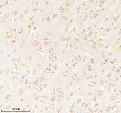 Immunohistochemical staining of NRTN using anti-NRTN antibody. NRTN was detected in a paraffin-embedded section of rat brain tissue. Heat mediated antigen retrieval was performed in EDTA buffer (pH 8.0, epitope retrieval solution). The tissue section was blocked with 10% goat serum. The tissue section was then incubated with 2 ug/ml rabbit anti-NRTN antibody overnight at 4oC. Peroxidase Conjugated Goat Anti-rabbit IgG was used as secondary antibody and incubated for 30 minutes at 37oC. The tissue section was developed using an HRP secondary and DAB substrate.