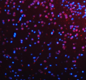 Immunofluorescent staining of FFPE mouse brain tissue with HTATSF1 antibody (red) and DAPI nuclear stain (blue). HIER: steam section in pH8 EDTA buffer for 20 min.
