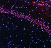 Immunofluorescent staining of FFPE rat brain tissue with HTATSF1 antibody (red) and DAPI nuclear stain (blue). HIER: steam section in pH8 EDTA buffer for 20 min.