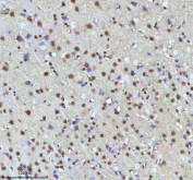 Immunohistochemical staining of HTATSF1 using anti-HTATSF1 antibody. HTATSF1 was detected in a paraffin-embedded section of rat brain tissue. Heat mediated antigen retrieval was performed in EDTA buffer (pH 8.0, epitope retrieval solution). The tissue section was blocked with 10% goat serum. The tissue section was then incubated with 2 ug/ml rabbit anti-HTATSF1 antibody overnight at 4oC. Peroxidase Conjugated Goat Anti-rabbit IgG was used as secondary antibody and incubated for 30 minutes at 37oC. The tissue section was developed using an HRP secondary and DAB substrate.