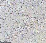 Immunohistochemical staining of HTATSF1 using anti-HTATSF1 antibody. HTATSF1 was detected in a paraffin-embedded section of rat brain tissue. Heat mediated antigen retrieval was performed in EDTA buffer (pH 8.0, epitope retrieval solution). The tissue section was blocked with 10% goat serum. The tissue section was then incubated with 2 ug/ml rabbit anti-HTATSF1 antibody overnight at 4oC. Peroxidase Conjugated Goat Anti-rabbit IgG was used as secondary antibody and incubated for 30 minutes at 37oC. The tissue section was developed using an HRP secondary and DAB substrate.