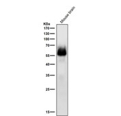 Western blot testing of mouse brain tissue lysate with Phospho-Chk2 (Ser33/Ser35) antibody at 1:1000 dilution for 1 hour at room temperature. Predicted molecular weight ~61 kDa.