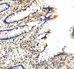 Immunohistochemical staining of PPP2R5E using anti-PPP2R5E antibody. PPP2R5E was detected in a paraffin-embedded section of human colon tissue. Heat mediated antigen retrieval was performed in EDTA buffer (pH 8.0, epitope retrieval solution). The tissue section was blocked with 10% goat serum. The tissue section was then incubated with 2 ug/ml rabbit anti-PPP2R5E antibody overnight at 4oC. Peroxidase Conjugated Goat Anti-rabbit IgG was used as secondary antibody and incubated for 30 minutes at 37oC. The tissue section was developed using an HRP secondary and DAB substrate.