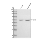 Western blot analysis of PPP2R5E using anti-PPP2R5E antibody. Electrophoresis was performed on a 10% SDS-PAGE gel at 80V (Stacking gel) / 120V (Resolving gel) for 2 hours. Lane 1: rat brain tissue lysates, Lane 2: mouse brain tissue lysates. After electrophoresis, proteins were transferred to a nitrocellulose membrane at 150 mA for 50-90 minutes. Blocked the membrane with 5% non-fat milk/TBS for 1.5 hour at RT. The membrane was incubated with rabbit anti-PPP2R5E antibody at 0.5 ug/ml overnight at 4oC, then washed with TBS-0.1%Tween 3 times with 5 minutes each and probed with a goat anti-rabbit IgG-HRP secondary antibody at a dilution of 1:5000 for 1.5 hour at RT. The signal was developed using an ECL Plus Western Blotting Substrate. The expected molecular weight of PPP2R5E is 46-55 kDa (multiple isoforms).