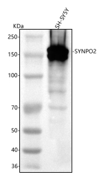 Western blot analysis of SYNPO2 using anti-SYNPO2 antibody. Lane 1: human SH-SY5Y whole cell lysates. After electrophoresis, proteins were transferred to a nitrocellulose membrane at 150 mA for 50-90 minutes. Blocked the membrane with 5% non-fat milk/TBS for 1.5 hour at RT. The membrane was incubated with rabbit anti-SYNPO2 antibody at 0.25 ug/ml overnight at 4oC, then washed with TBS-0.1%Tween 3 times with 5 minutes each and probed with a goat anti-rabbit IgG-HRP secondary antibody at a dilution of 1:5000 for 1.5 hour at RT. The signal was developed using enhanced chemiluminescent. Expected molecular weight of SYNPO2 ~118 kDa. In human tumor cell lysate we observe a heavy doublet at ~150 kDa. While peer-reviewed published Western blots of SYNPO2 do not consistently list a 150~160 kDa band, the gene is known to encode multiple splice variants and exhibits variable apparent migration. The upward shift likely reflects a longer isoform or post-translationally modified/complexed form of SYNPO2.