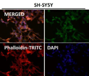 Immunofluorescent analysis using the HOXC6 antibody (green) at 1:150 dilution.