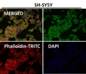 Immunofluorescent analysis using the HOXC6 antibody (green) at 1:50 dilution.