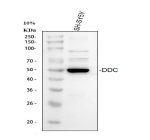 Western blot analysis of DDC using anti-DDC antibody. Electrophoresis was performed on a 10% SDS-PAGE gel at 80V (Stacking gel) / 120V (Resolving gel) for 2 hours. Lane 1: human SHSY-5Y whole cell lysates, Lane 2: human Caco-2 whole cell lysates, Lane 3: human HepG2 whole cell lysates, Lane 4: rat NRK whole cell lysates, Lane 5: rat PC-12 whole cell lysates, Lane 6: mouse kidney tissue lysates. After electrophoresis, proteins were transferred to a nitrocellulose membrane at 150 mA for 50-90 minutes. Blocked the membrane with 5% non-fat milk/TBS for 1.5 hour at RT. The membrane was incubated with rabbit anti-DDC antibody at 0.5 ug/ml overnight at 4oC, then washed with TBS-0.1%Tween 3 times with 5 minutes each and probed with a goat anti-rabbit IgG-HRP secondary antibody at a dilution of 1:5000 for 1.5 hour at RT. The signal was developed using an ECL Plus Western Blotting Substrate. The expected molecular weight of DDC is ~54 kDa.