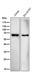 All lanes use the ACADVL antibody at 1:5K dilution for 1 hour at room temperature. Predicted molecular weight ~68 kDa.