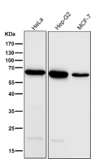 All lanes use the ACADVL antibody at 1:5000 dilution for 1 hour at room temperature. Predicted molecular weight ~68 kDa.