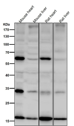 All lanes use the SDHC antibody at 1:6K dilution for 1 hour at room temperature. Predicted molecular weight: 12-19 kDa (multiple isoforms). Bands seen at higher molecular weights may represent SDHC heterodimers.