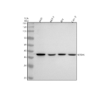 Western blot analysis of NSDHL using anti-NSDHL antibody. Lane 1: human whole cell lysates, Lane 2: human MCF-7 whole cell lysates, Lane 3: human RT4 whole cell lysates, Lane 4: human CACO-2 whole cell lysates. After electrophoresis, proteins were transferred to a nitrocellulose membrane at 150 mA for 50-90 minutes. Blocked the membrane with 5% non-fat milk/TBS for 1.5 hour at RT. The membrane was incubated with rabbit anti-NSDHL antibody at 1:500 overnight at 4oC, then washed with TBS-0.1%Tween 3 times with 5 minutes each and probed with a goat anti-rabbit IgG-HRP secondary antibody at a dilution of 1:500 for 1.5 hour at RT. The signal was developed using enhanced chemiluminescent. The expected molecular weight of NSDHL is ~42 kDa.