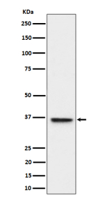 Western blot analysis of ULBP1 expression in HeLa cell lysate using ULBP1 antibody. ULBP1 (~28 kDa predicted) seen here at ~36 kDa in Western blot is consistent with its known glycosylation and postâtranslational modifications.