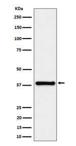 Western blot analysis of UCHL5IP/HAUS7 expression in HeLa cell lysate using HAUS7 antibody. Predicted molecular weight ~40 kDa.
