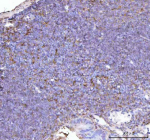Immunohistochemical staining of NCF1 using anti- NCF1 antibody. NCF1 was detected in a paraffin-embedded section of mouse lymph tissue. Heat mediated antigen retrieval was performed in EDTA buffer (pH 8.0, epitope retrieval solution). The tissue section was blocked with 10% goat serum. The tissue section was then incubated with 2 ug/ml rabbit anti- NCF1 antibody overnight at 4oC. Peroxidase Conjugated Goat Anti-rabbit IgG was used as secondary antibody and incubated for 30 minutes at 37oC. The tissue section was developed using an HRP secondary and DAB substrate.