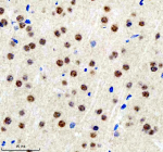 Immunohistochemical staining of BCLAF1 using anti-BCLAF1 antibody. BCLAF1 was detected in a paraffin-embedded section of mouse brain tissue. Heat mediated antigen retrieval was performed in EDTA buffer (pH 8.0, epitope retrieval solution). The tissue section was blocked with 10% goat serum. The tissue section was then incubated with 2 ug/ml rabbit anti-BCLAF1 antibody overnight at 4oC. Peroxidase Conjugated Goat Anti-rabbit IgG was used as secondary antibody and incubated for 30 minutes at 37oC. The tissue section was developed using an HRP secondary and DAB substrate.