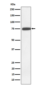 Western blot analysis of GNE expression in K562 cell lysate using GNE antibody. Predicted molecular weight: 67-83 kDa (multiple isoforms).