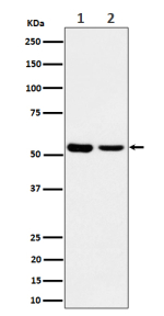 Western blot analysis of AAMP expression in (1) lysate; (2) MCF7 cell lysate using AAMP antibody. Predicted molecular weight: ~47 kDa.