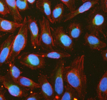 Immunofluorescent staining of RHOT2 using anti-RHOT2 antibody (green) and anti-Tubulin Alpha antibody (red). RHOT2 was detected in immunocytochemical section of U2OS cell. Enzyme antigen retrieval was performed using IHC enzyme antigen retrieval reagent for 15 mins. The cells were blocked with 10% goat serum. And then incubated with 5 ug/ml rabbit anti-RHOT2 antibody and mouse anti-Tubulin Alpha antibody overnight at 4oC. DyLight 488 Conjugated Goat Anti-Rabbit IgG and Cy3 Conjugated Goat Anti-Mouse IgG were used as secondary antibody at 1:500 dilution and incubated for 30 minutes at 37oC. The section was counterstained with DAPI nuclear stain (blue). Visualize using a fluorescence microscope and filter sets appropriate for the label used.