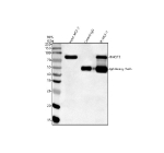 Immunoprecipitation of RHOT2 in MCF-7 whole cell lysate. Western blot analysis of RHOT2 using anti-RHOT2 antibody; Lane 1: MCF-7 whole cell lysates (30ug); Lane 2: Rabbit control IgG instead of anti-RHOT2 antibody in MCF-7 whole cell lysate; Lane 3: anti-RHOT2 antibody (2ug) + MCF-7 whole cell lysate (500ug). After electrophoresis, proteins were transferred to a membrane. Then the membrane was incubated with rabbit anti-RHOT2 antibody at a dilution of 0.5 ug/ml and probed with a goat anti-rabbit IgG-HRP secondary antibody. The signal is developed using ECL Plus Western Blotting Substrate. RHOT2 (MIRO2) was detected at 75-80 kDa, consistent with the phosphorylated and post-translationally modified forms described in peer-reviewed studies. The upward shift from the ~68 kDa predicted size likely reflects PINK1-dependent phosphorylation and related mitochondrial quality-control modifications.