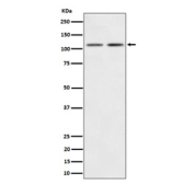 Western blot analysis of Kinase beta expression in (1) human 293 cell lysate; (2) mouse Brain lysate using PIK3CB antibody. Predicted molecular weight ~110 kDa.