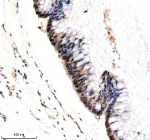 Immunohistochemical staining of PIK3CB using anti- PIK3CB antibody. PIK3CB was detected in a paraffin-embedded section of human colon tissue. Heat mediated antigen retrieval was performed in EDTA buffer (pH 8.0, epitope retrieval solution). The tissue section was blocked with 10% goat serum. The tissue section was then incubated with 1: 50 rabbit anti- PIK3CB antibody overnight at 4oC. Peroxidase Conjugated Goat Anti-rabbit IgG was used as secondary antibody and incubated for 30 minutes at 37oC. The tissue section was developed using an HRP secondary and DAB substrate.