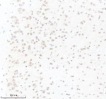 Immunohistochemical staining of PIK3CB using anti- PIK3CB antibody. PIK3CB was detected in a paraffin-embedded section of rat brain tissue. Heat mediated antigen retrieval was performed in EDTA buffer (pH 8.0, epitope retrieval solution). The tissue section was blocked with 10% goat serum. The tissue section was then incubated with 1: 50 rabbit anti- PIK3CB antibody overnight at 4oC. Peroxidase Conjugated Goat Anti-rabbit IgG was used as secondary antibody and incubated for 30 minutes at 37oC. The tissue section was developed using an HRP secondary and DAB substrate.