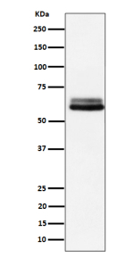 Western blot analysis of BIN1 expression in human A431 cell lysate. Predicted molecular weight: 46-90 kDa (multiple isoforms).