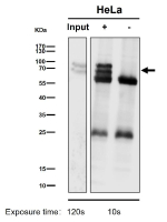 Immunoprecipitation analysis using the antibody at 1:50 dilution. Western blot testing at 1:1K dilution. Predicted molecular weight: 46-90 kDa (multiple isoforms).
