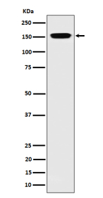 Western blot analysis of NUP155 expression in human 293 cell lysate using NUP155 antibody. Predicted molecular weight ~155 kDa.