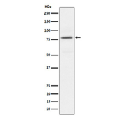 Western blot analysis of Phospho-PKC alpha (T497) expression in HeLa treated with Calyculin A cell lysate, using Phospho-PKC alpha (Thr497) antibody.
