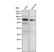 All lanes use the Phospho-PKC alpha (Thr497) antibody at 1:1K dilution for 1 hour at room temperature.