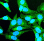 Immunofluorescent staining of TGFBI using anti-TGFBI antibody (green). TGFBI was detected in an immunocytochemical section of Hela cells. Enzyme antigen retrieval was performed using IHC enzyme antigen retrieval reagent for 15 mins. The cells were blocked with 10% goat serum. And then incubated with 5 ug/ml rabbit anti-TGFBI antibody overnight at 4oC. DyLight 488 Conjugated Goat Anti-Rabbit IgG was used as secondary antibody at 1:500 dilution and incubated for 30 minutes at 37oC. The section was counterstained with DAPI nuclear stain (blue). Visualize using a fluorescence microscope and filter sets appropriate for the label used.