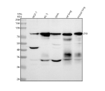 Western blot analysis of Zyxin using anti-Zyxin antibody. Lane 1: human MCF-7 whole cell lysates, Lane 2: human PC-3 whole cell lysates, Lane 3: human SIHA whole cell lysates, Lane 4: rat lung tissue lysates, Lane 5: mouse lung tissue lysates. After electrophoresis, proteins were transferred to a nitrocellulose membrane at 150 mA for 50-90 minutes. Blocked the membrane with 5% non-fat milk/TBS for 1.5 hour at RT. The membrane was incubated with rabbit anti-Zyxin antibody at 1:1000 overnight at 4oC, then washed with TBS-0.1%Tween 3 times with 5 minutes each and probed with a goat anti-rabbit IgG-HRP secondary antibody at a dilution of 1:500 for 1.5 hour at RT. The signal was developed using enhanced chemiluminescent. Zyxin (ZYX, ~61 kDa predicted) was detected at ~75-80 kDa, consistent with its phosphorylated and isoform-dependent mobility reported in the literature. Lower bands (~35-45 kDa) likely represent proteolytic fragments generated during turnover or stress responses.