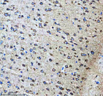 Immunohistochemical staining of PTN/Pleiotrophin using anti-Pleiotrophin antibody. Pleiotrophin was detected in a paraffin-embedded section of rat brain tissue. Heat mediated antigen retrieval was performed in EDTA buffer (pH 8.0, epitope retrieval solution). The tissue section was blocked with 10% goat serum. The tissue section was then incubated with 1:50 rabbit anti-Pleiotrophin antibody overnight at 4oC. Peroxidase Conjugated Goat Anti-rabbit IgG was used as secondary antibody and incubated for 30 minutes at 37oC. The tissue section was developed using an HRP secondary and DAB substrate.