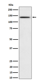Western blot analysis of Phospho-BCAR1 (Y410) expression in HeLa treated with pervanadate cell lysate, using Phospho-BCAR1 (Tyr410) antibody.