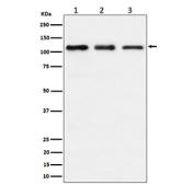 Western blot analysis of TAOK1 expression in (1) human HeLa cell lysate; (2) mouse RAW264.7 cell lysate; (3) rat C6 cell lysate. Predicted molecular weight ~116 kDa.