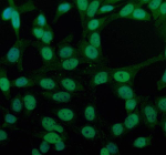 Immunofluorescent staining of PPP1R8 using anti-PPP1R8 antibody (green). PPP1R8 was detected in an immunocytochemical section of Hela cells. Enzyme antigen retrieval was performed using IHC enzyme antigen retrieval reagent for 15 mins. The cells were blocked with 10% goat serum. And then incubated with 5 ug/ml rabbit anti-PPP1R8 antibody overnight at 4oC. DyLight 488 Conjugated Goat Anti-Rabbit IgG was used as secondary antibody at 1:500 dilution and incubated for 30 minutes at 37oC. The section was counterstained with DAPI nuclear stain (blue). Visualize using a fluorescence microscope and filter sets appropriate for the label used.