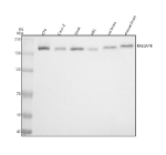 Western blot analysis of RALGAPB using anti-RALGAPB antibody. Electrophoresis was performed on a 8% SDS-PAGE gel at 80V (Stacking gel) / 120V (Resolving gel) for 2 hours. Lane 1: human RT4 whole cell lysates, Lane 2: human Caco-2 whole cell lysates, Lane 3: human SIHA whole cell lysates, Lane 4: human HEL whole cell lysates, Lane 5: rat brain tissue lysates, Lane 6: mouse brain tissue lysates. After electrophoresis, proteins were transferred to a nitrocellulose membrane at 150 mA for 50-90 minutes. Blocked the membrane with 5% non-fat milk/TBS for 1.5 hour at RT. The membrane was incubated with rabbit anti-RALGAPB antibody at 0.5 ug/ml overnight at 4oC, then washed with TBS-0.1%Tween 3 times with 5 minutes each and probed with a goat anti-rabbit IgG-HRP secondary antibody at a dilution of 1:5000 for 1.5 hour at RT. The signal was developed using an ECL Plus Western Blotting Substrate. RALGAPB (~167 kDa predicted) was detected at ~185-190 kDa, consistent with the slower electrophoretic migration caused by its extended coiled-coil structure and complex formation with RALGAPA subunits.