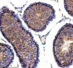 Immunohistochemical staining of RALGAPB using anti-RALGAPB antibody. RALGAPB was detected in a paraffin-embedded section of rat testis tissue. Heat mediated antigen retrieval was performed in EDTA buffer (pH 8.0, epitope retrieval solution). The tissue section was blocked with 10% goat serum. The tissue section was then incubated with 2 ug/ml rabbit anti-RALGAPB antibody overnight at 4oC. Peroxidase Conjugated Goat Anti-rabbit IgG was used as secondary antibody and incubated for 30 minutes at 37oC. The tissue section was developed using an HRP secondary and DAB substrate.