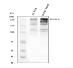 Western blot analysis of SHANK1 using anti-SHANK1 antibody. Electrophoresis was performed on a 8% SDS-PAGE gel at 80V (Stacking gel) / 120V (Resolving gel) for 2 hours. Lane 1: rat brain tissue lysates, Lane 2: mouse brain tissue lysates. After electrophoresis, proteins were transferred to a nitrocellulose membrane at 150 mA for 50-90 minutes. Blocked the membrane with 5% non-fat milk/TBS for 1.5 hour at RT. The membrane was incubated with rabbit anti-SHANK1 antibody at 0.5 ug/ml overnight at 4oC, then washed with TBS-0.1%Tween 3 times with 5 minutes each and probed with a goat anti-rabbit IgG-HRP secondary antibody at a dilution of 1:5000 for 1.5 hour at RT. The signal was developed using an ECL Plus Western Blotting Substrate. SHANK1 (~225 kDa predicted) was detected in brain lysates as major bands migrating at ~160-250 kDa, consistent with full-length and variant SHANK1 proteins. Additional bands migrating at ~100-120 kDa may represent truncated or alternative translation forms of SHANK1.