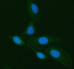 Immunofluorescent staining of Galectin-3/LGALS3 using anti-LGALS3 antibody (green). Galectin-3/LGALS3 was detected in an immunocytochemical section of HELA cells. Enzyme antigen retrieval was performed using IHC enzyme antigen retrieval reagent for 15 mins. The cells were blocked with 10% goat serum. And then incubated with 5 ug/ml rabbit anti-LGALS3 antibody overnight at 4oC. DyLight 488 Conjugated Goat Anti-Rabbit IgG was used as secondary antibody at 1:500 dilution and incubated for 30 minutes at 37oC. The section was counterstained with DAPI nuclear stain (blue). Visualize using a fluorescence microscope and filter sets appropriate for the label used.
