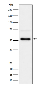 Western blot analysis of Phospho-Chk1 (S280) expression in 293T treated with Calyculin A cell lysate, using Phospho-Chk1 (Ser280) antibody.
