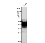All lanes use the SYPL1 antibody at 1:3K dilution for 1 hour at room temperature. SYPL1 (~28 kDa predicted) was detected as a predominant ~40 kDa band, consistent with published reports describing glycosylation-dependent and hydrophobicity-related slower migration of this vesicle membrane protein. Additional lower bands likely represent partially processed or unglycosylated forms.