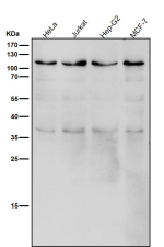 All lanes use the USP5 antibody at 1:1K dilution for 1 hour at room temperature. Predicted molecular weight ~96 kDa.